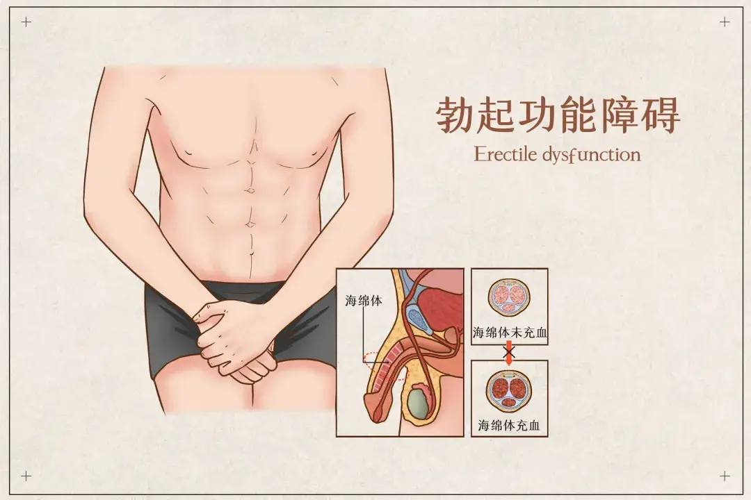 1774229927824500.png 勃起520男性藥局.png